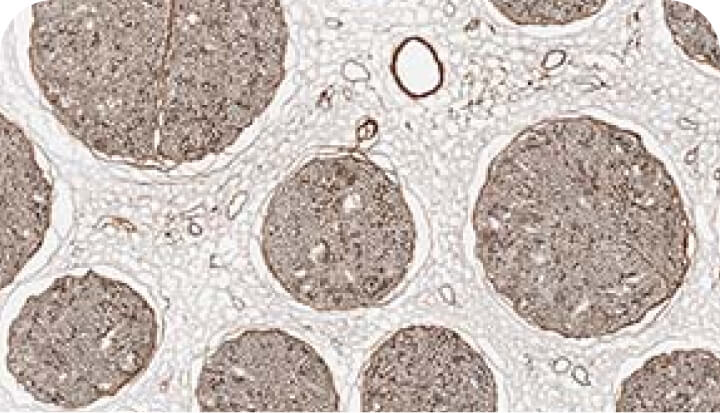 Microscope image of endoneurial tube assessment