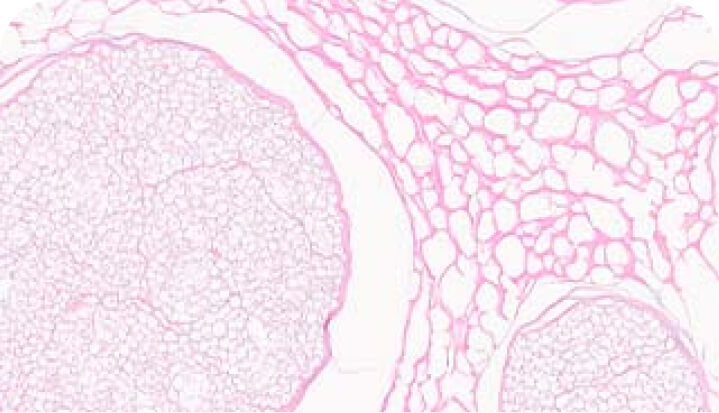 Microscope image of H+E stain