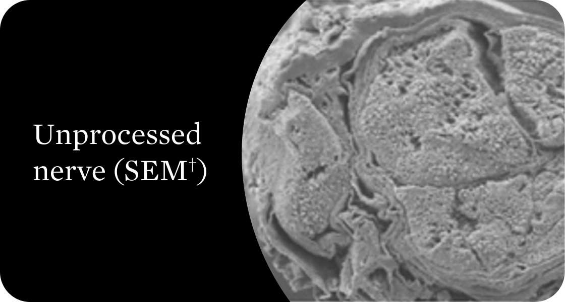 Scanning electron microscope image of unprocessed nerve