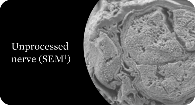 Scanning electron microscope image of unprocessed nerve